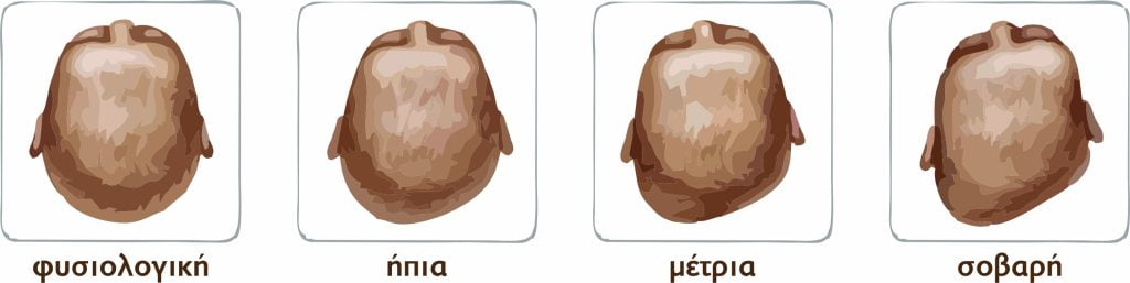 Γιατί το κεφαλάκι του μωρού μου δεν είναι συμμετρικό; Γιατί μπορεί να μοιάζει επίπεδο;