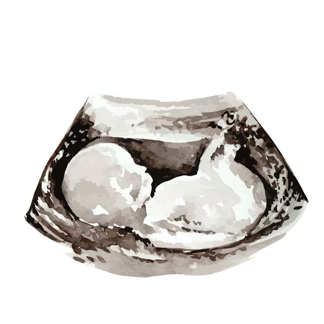 Τι βλέπει και τι ακούει το μωρό στη μήτρα;